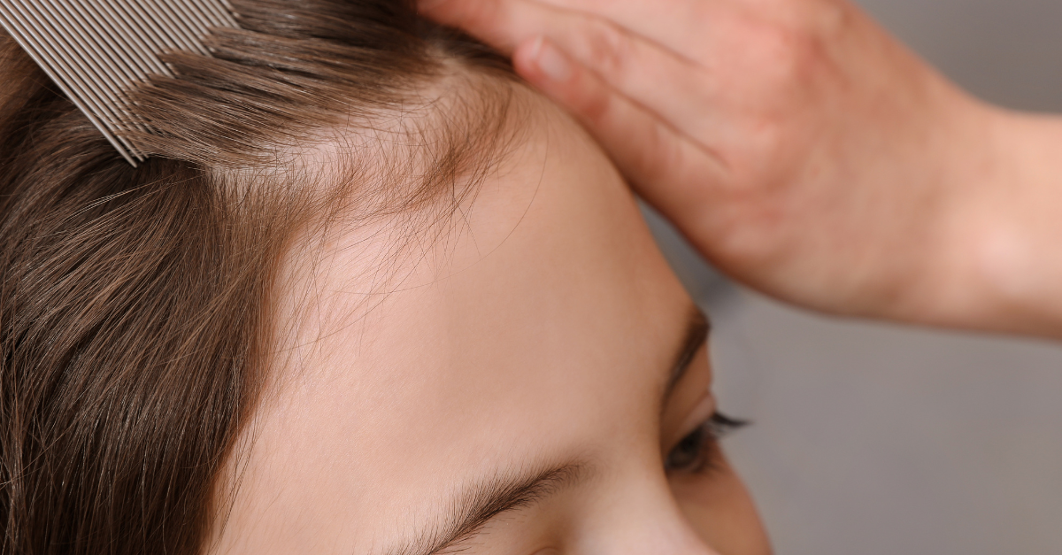 Fashionably Effective: The Lice Comb